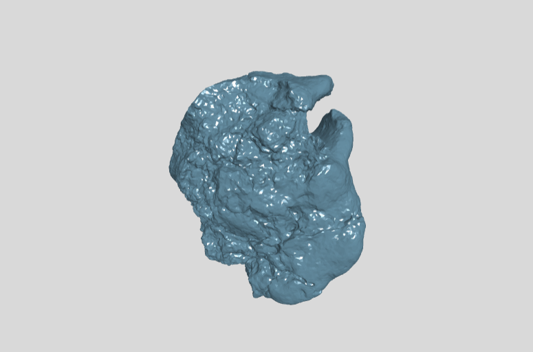 ANHM 1 326 Hadrosauridae indet pathological caudal vertebra