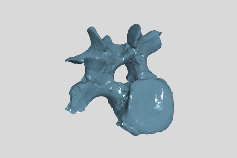 PM TGU 16.1-209 cervical vertebra 6