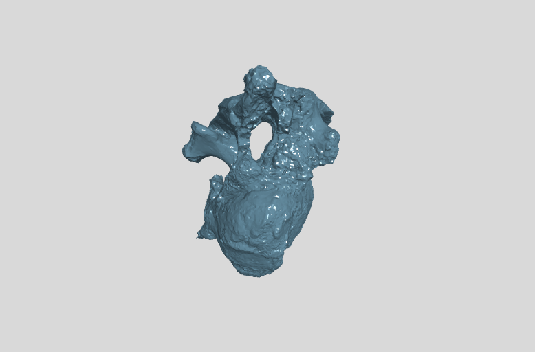 ANHM 2 845 19,20 (4,5) 5th cervical vertebra