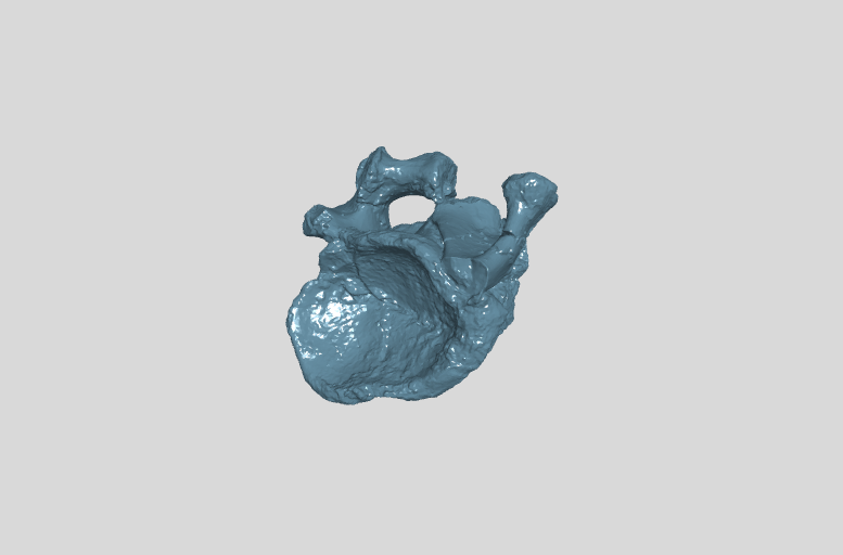 ANHM 2 845 23,24  7th cervical vertebra