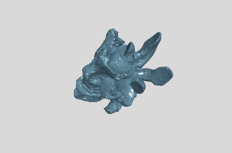 ANHM 2 845 27,28,30 (9,10)  9th and 10th cervical vertebrae