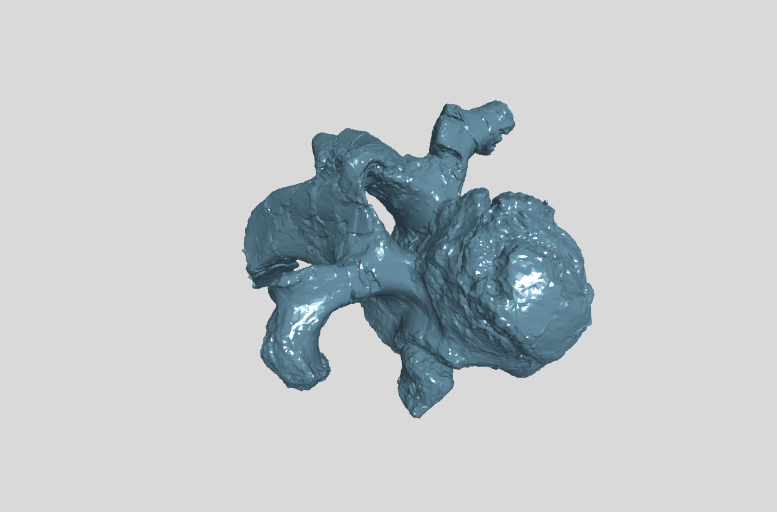 ANHM 2 845 31 (11)  11th cervical vertebra