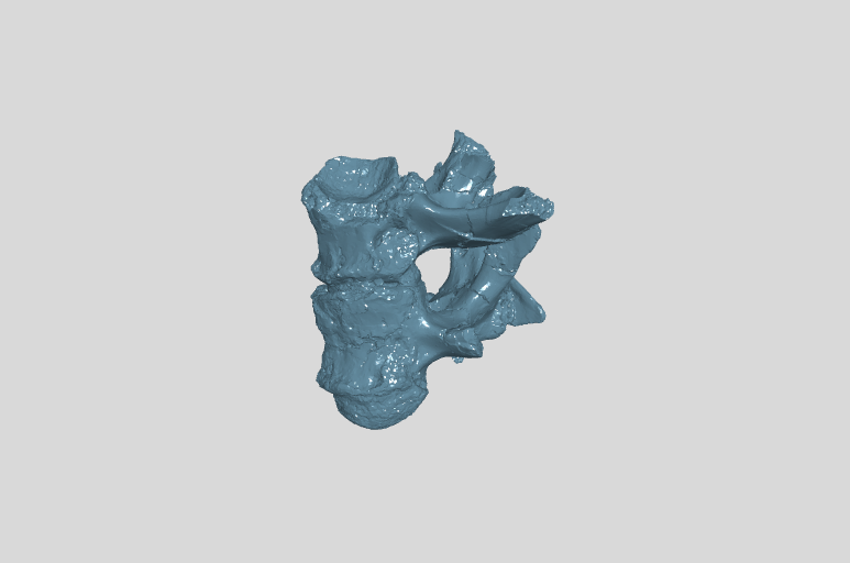 ANHM 2 845 38,39 (17,18)  17th and 18th cervical vertebrae