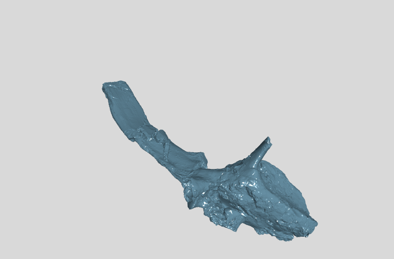 ANHM 2 845 58,63 (7)  7th cervical vertebra